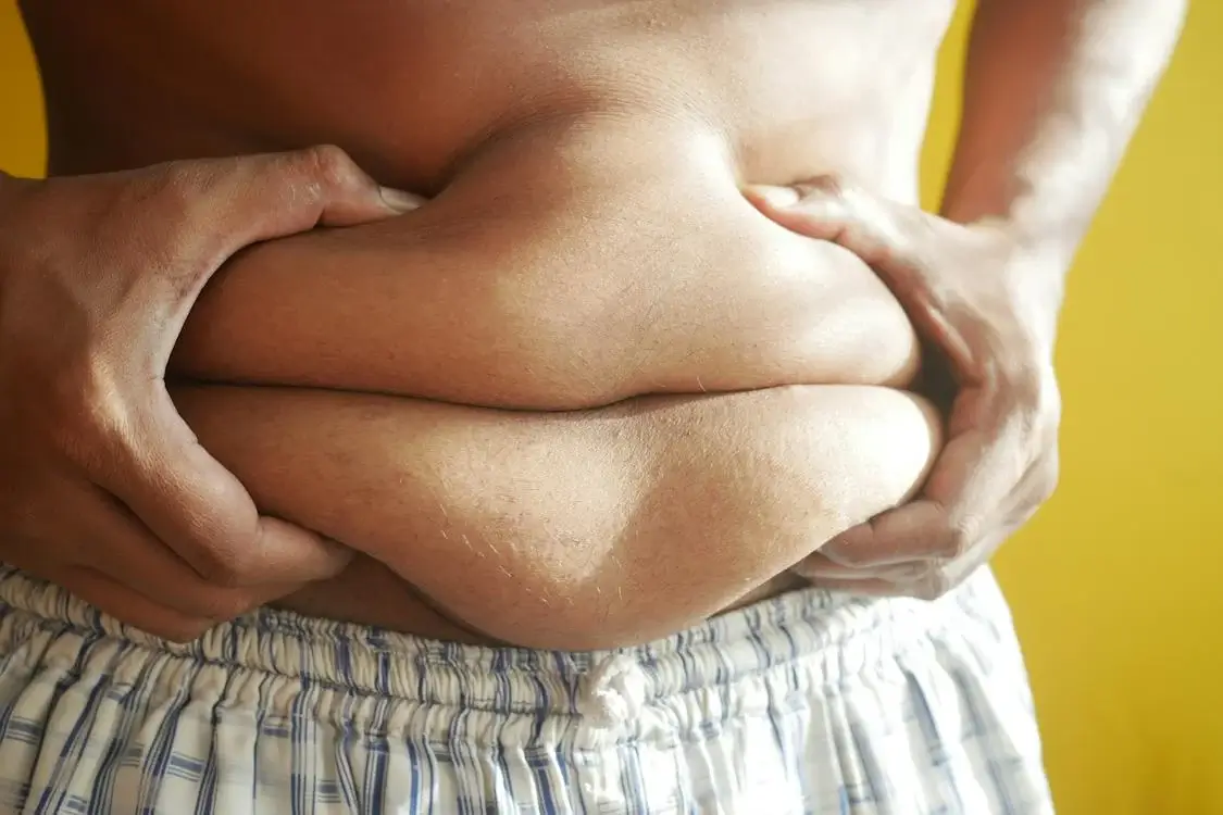 비만