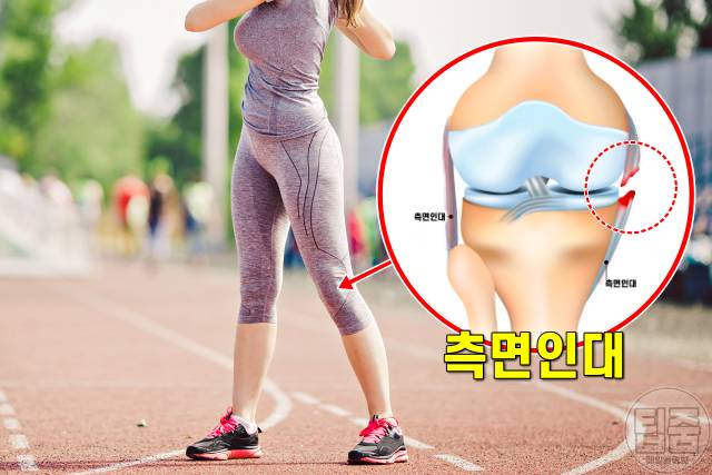 무릎 아플때 가는 병원,무릎이 돌아가면 측면인대