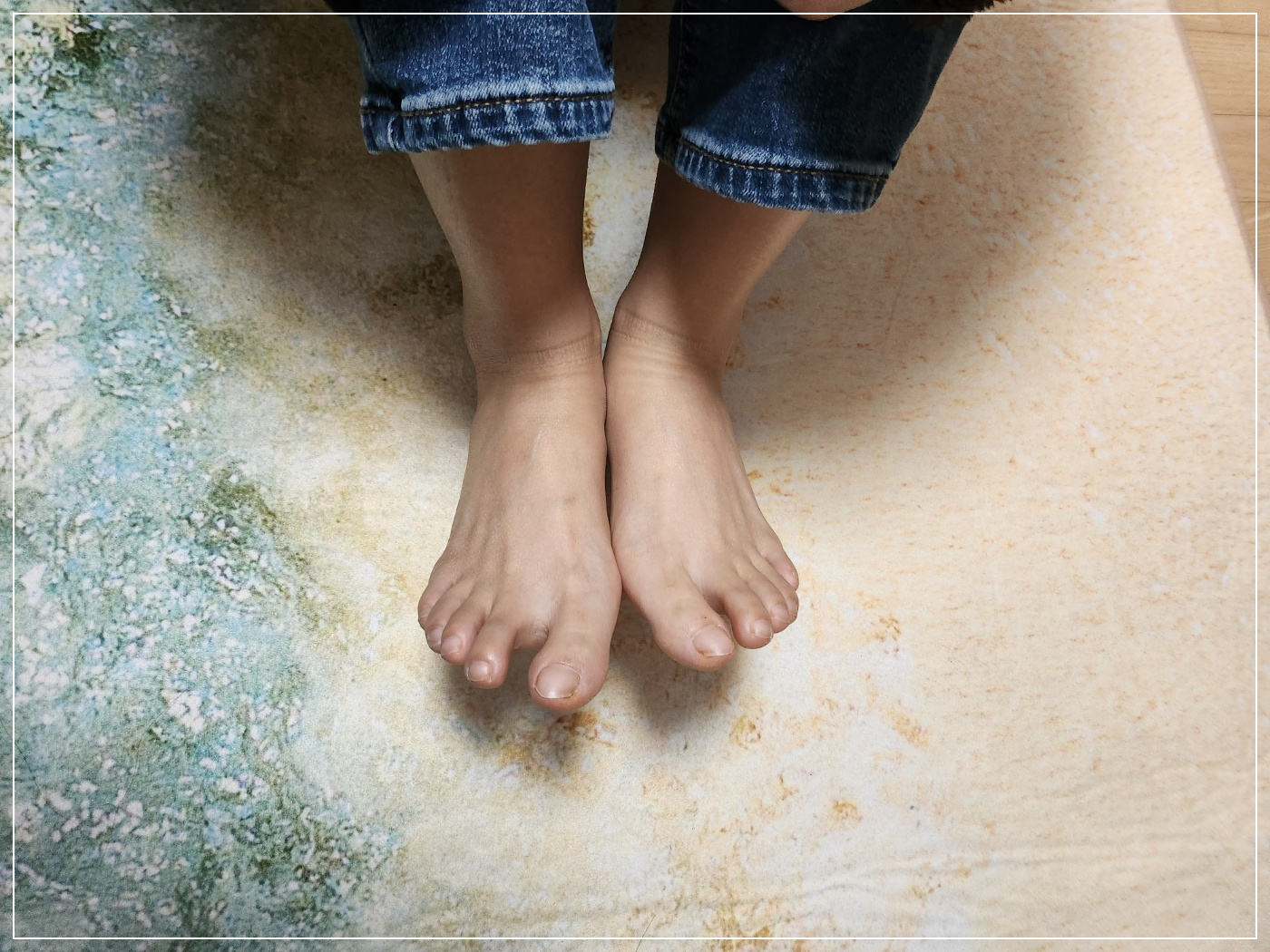 족저근막염발바닥 통증