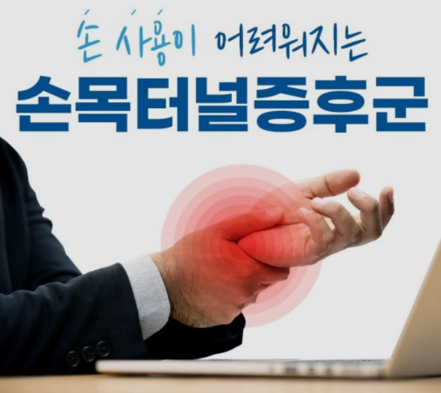 손목터널증후군