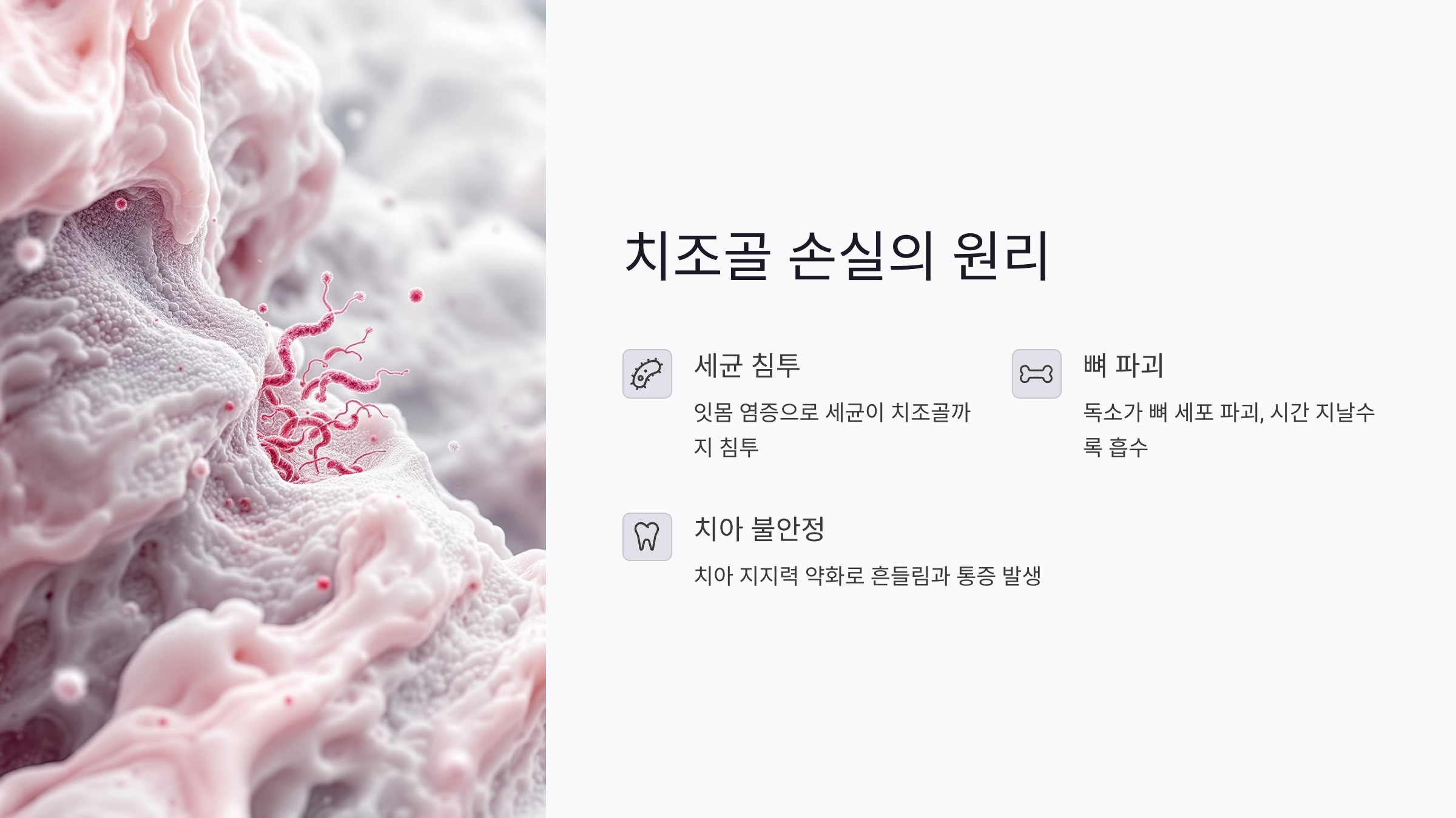 레이저 잇몸치료가 치조골 손실을 막는 원리