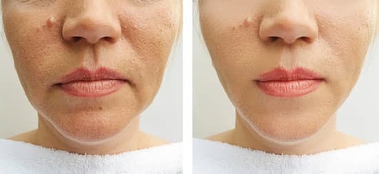 리프팅 시술 후 유지 루틴 &ndash; 효과를 오래 가게 하는 7가지 비법