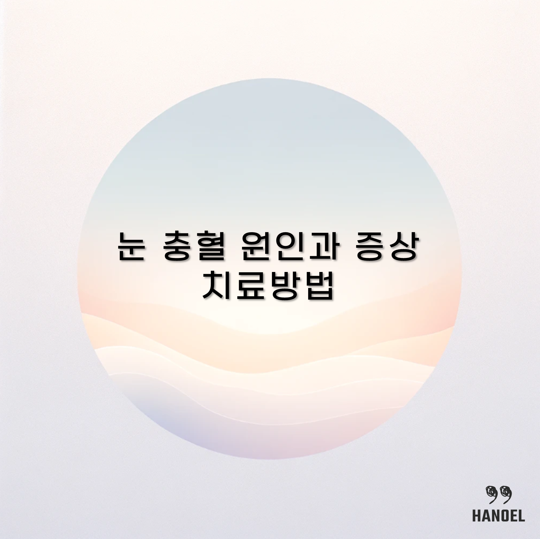 눈 충혈 원인과 증상(눈꼽&#44; 통증&#44; 두통&#44; 실핏줄 터짐) 및 치료방법