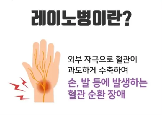 레이노 증후군