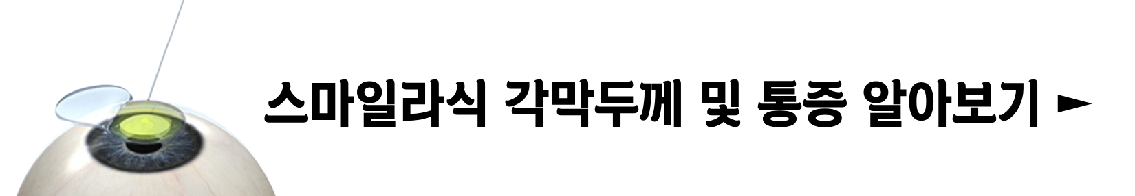 스마일라식 가격 회복기간 후기 부작용 비용 각막두께 통증 : 1분 요약(+2024)