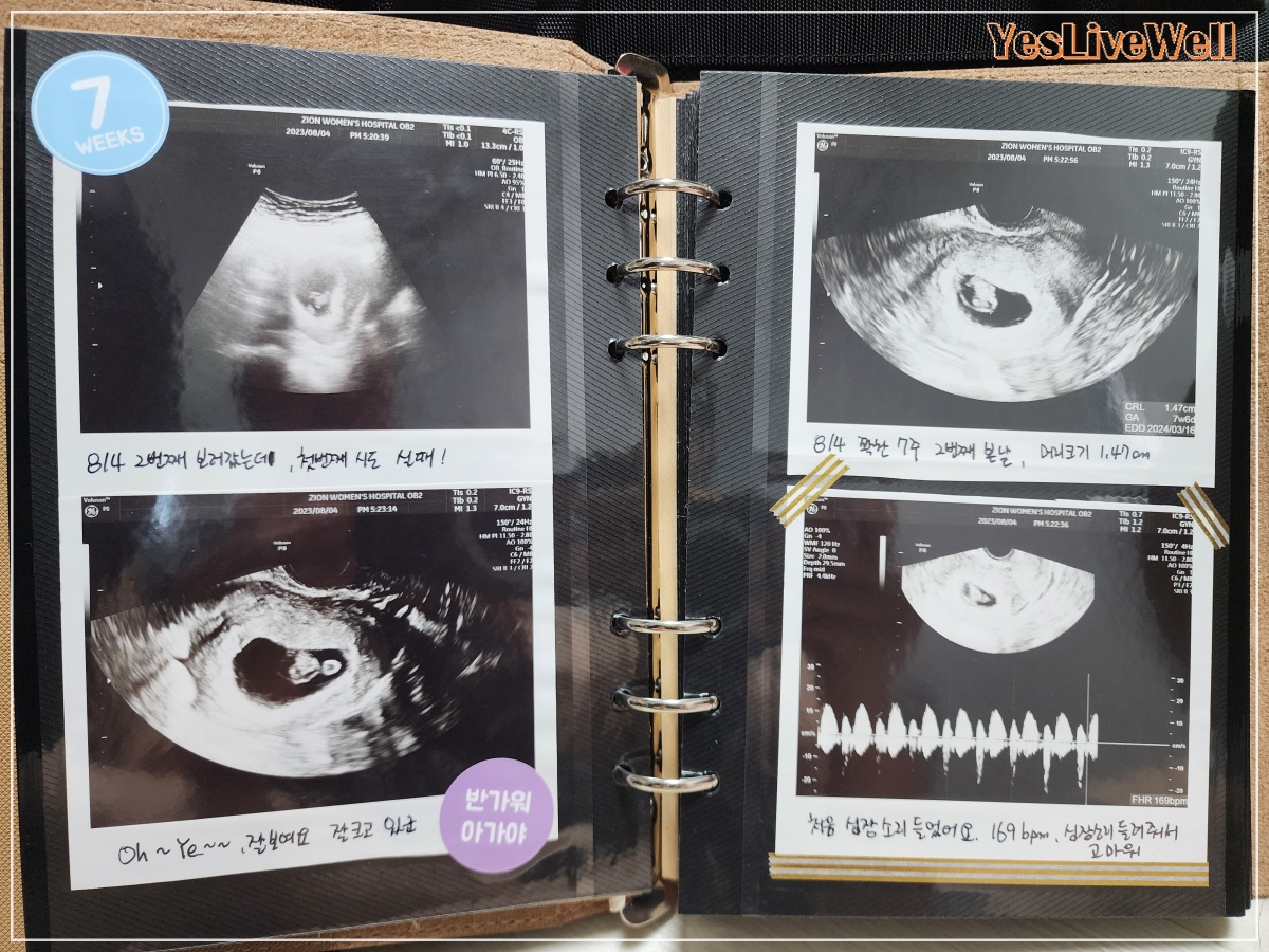 초음파-앨범-1