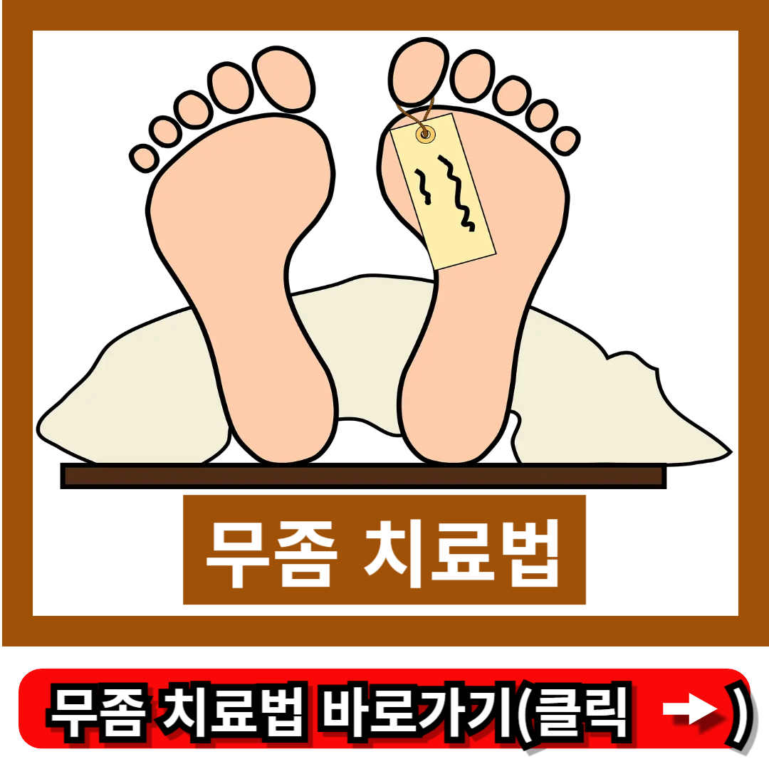 무좀 치료법