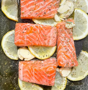 골다공증에 좋은 음식 영양제 식단