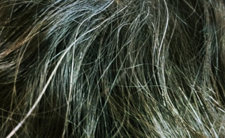 새치가-생긴-머리카락