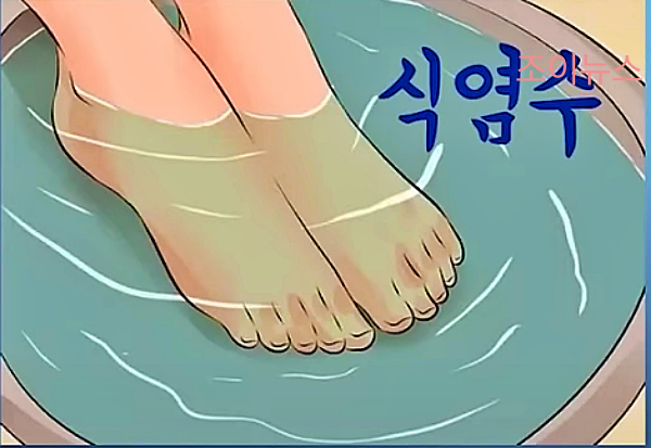 내성발톱 온수 족욕관리__출처:김범수교수의발편한세상