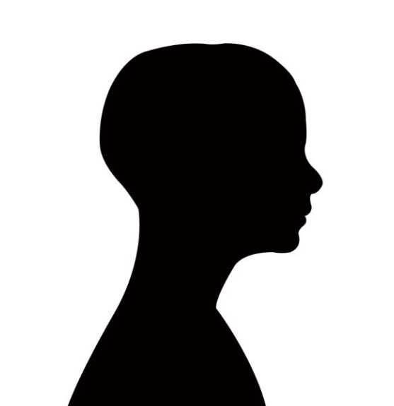 소아 탈모