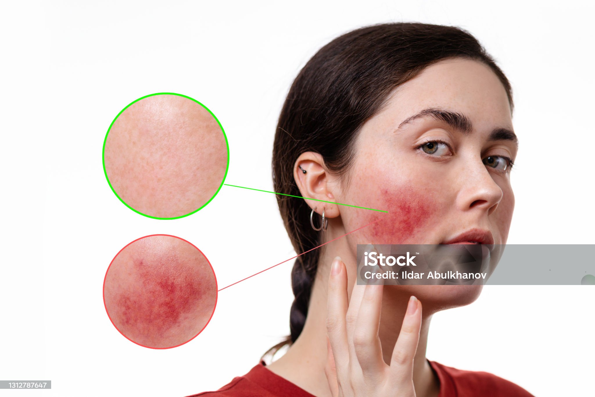 단독 관련 사진