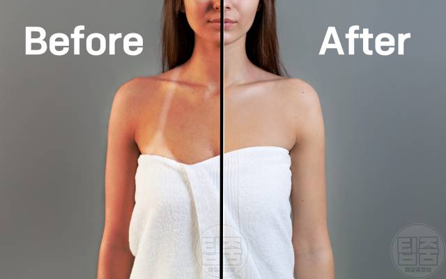 피부 탔을때 하얗게 얼굴 탄거 복구