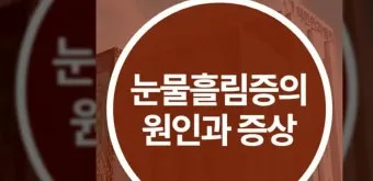 눈물이 자주 나는 이유에 대한 안과정보_9