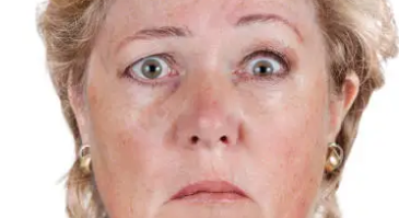 구안와사 초기증상 16