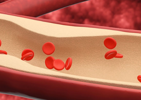 폴리코사놀 대표적 효능 혈관건강 증진3