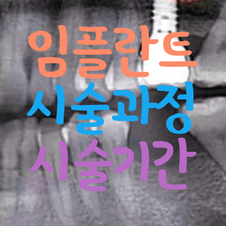 임플란트 모습