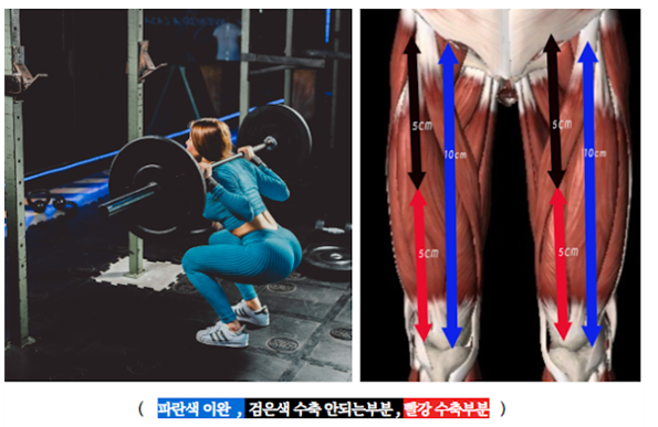 수축 구조의 차이