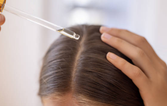 탈모 중 두피 건강을 지킨 3가지 방법