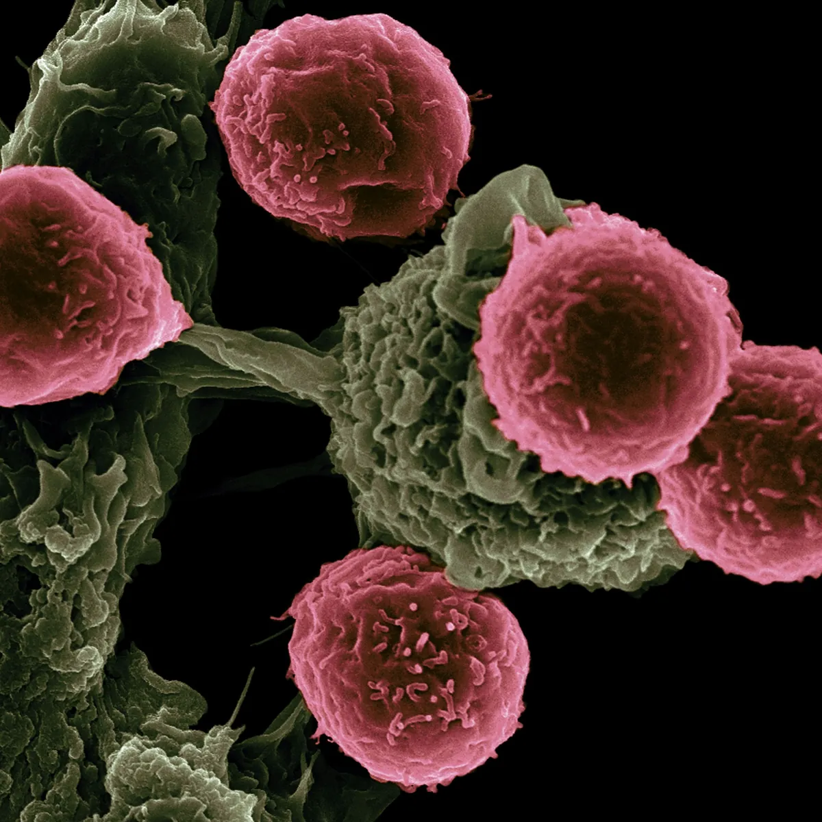 50대 암검진 우선순위 체크리스트