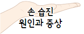 이 이미지를 클릭 하시면 한포진과 헷갈리기 쉬운 손습진에 관한 포스팅으로 이동 됩니다.