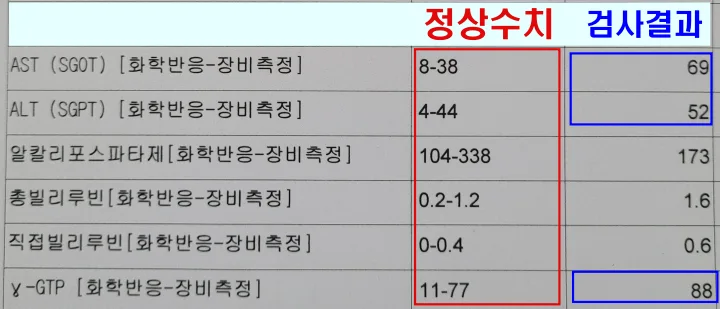 2023년-5월-간수치