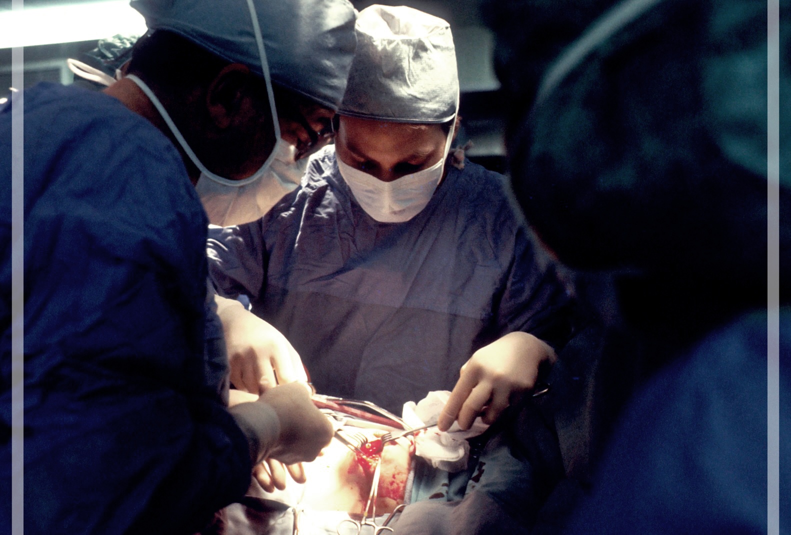 뇌동맥류 코일 색전술 비용 및 수술후기.