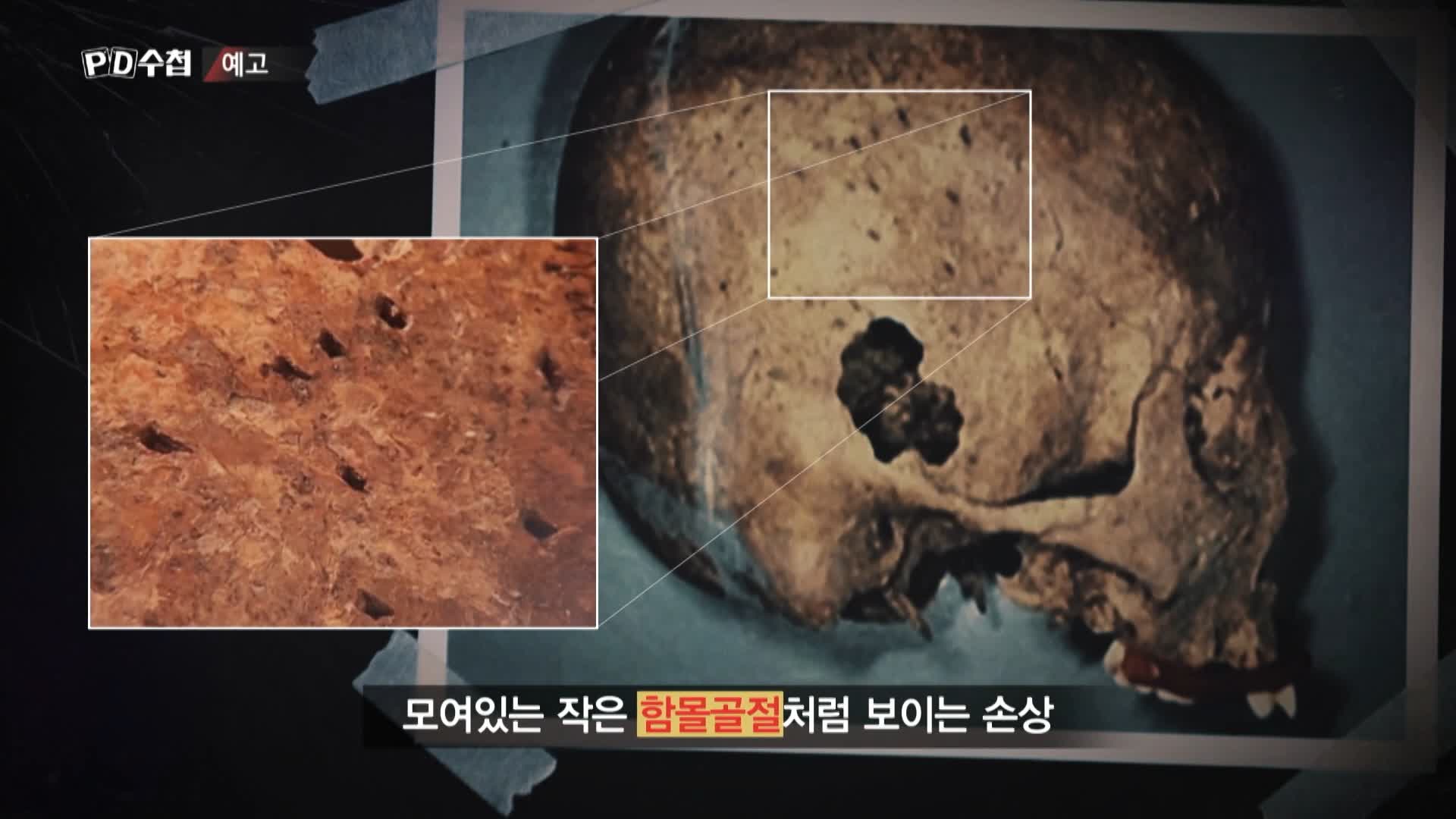 피디수첩 개구리소년 와룡산에 묻힌 진실 오늘방송 다시보기