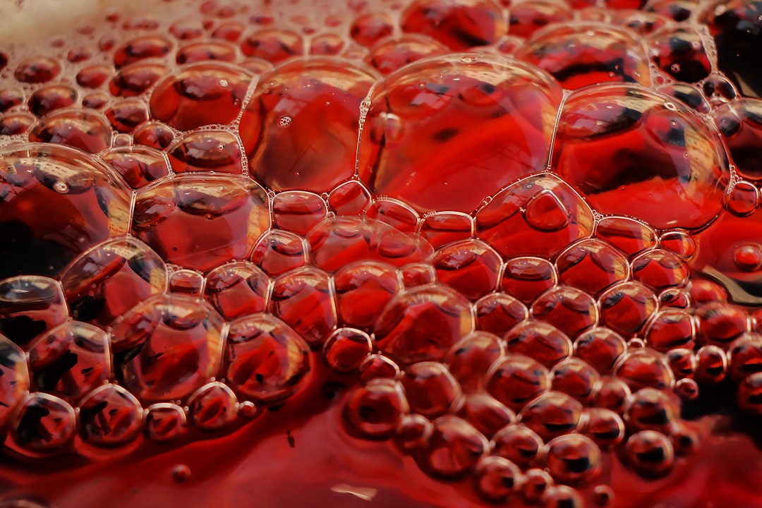 Anemia
