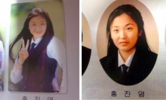 홍진영 성형 인정