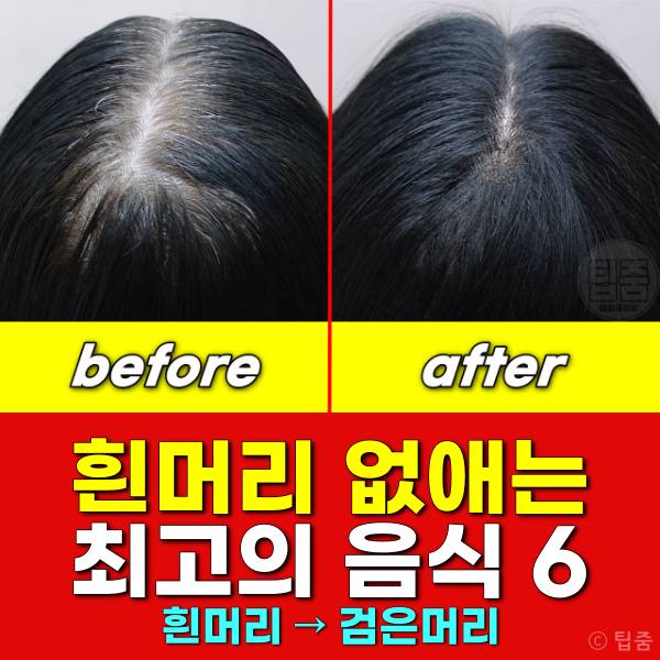 흰머리 없애는 음식 흰머리 검은머리로