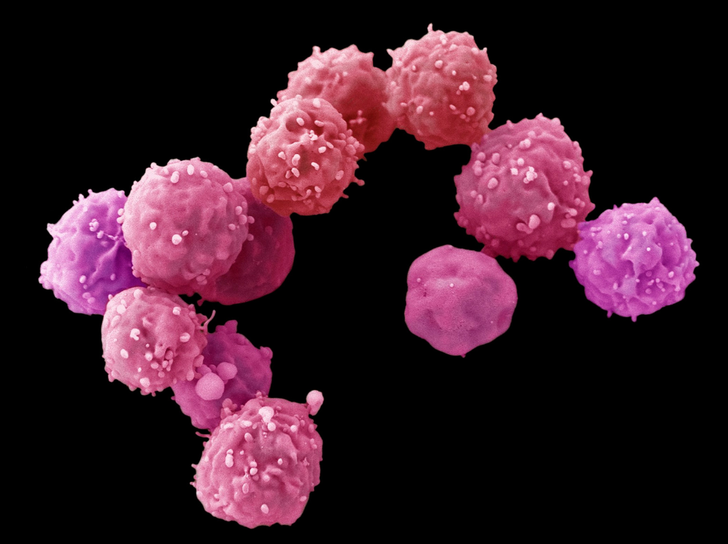 줄기 세포 치료