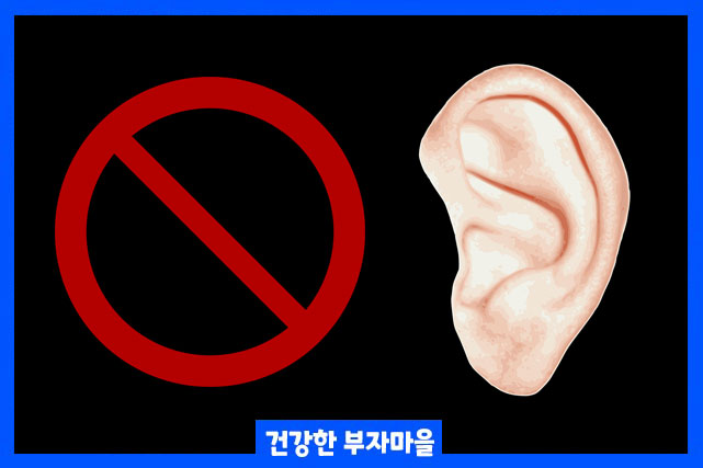 돌발성 난청 원인 7가지