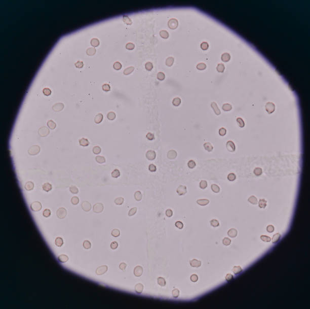 유레아플라즈마란? 감염 원인과 특징