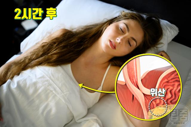 역류성식도염 자가치료 식사후 눕기