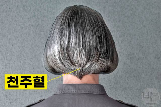 흰머리 나는 부위 뇌졸중 흰머리 부위별 원인