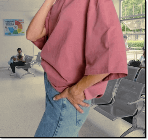 고관절 활액막염 증상