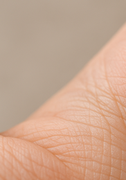 한포진 치료방법