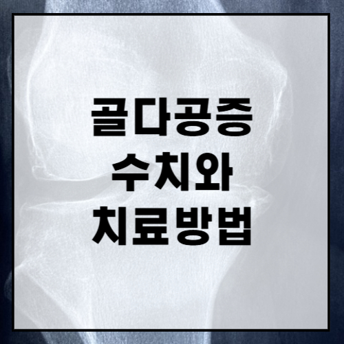골다공증-수치-치료-방법