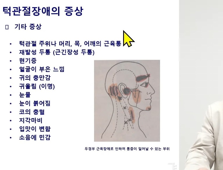 EBS명의-턱관절-고홍섭-교수