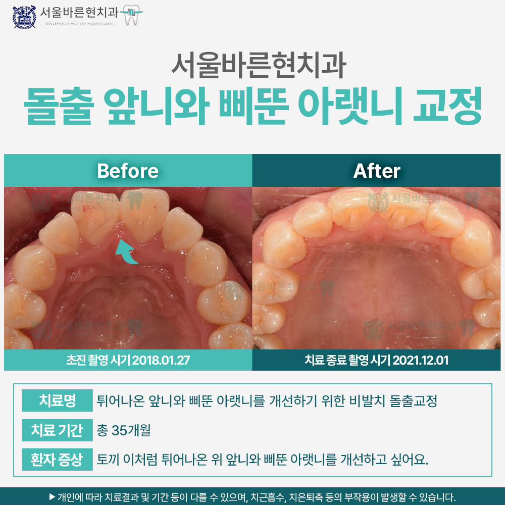 해운대교정치과