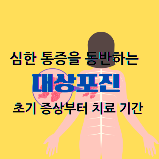 심한 통증을 동반하는 대상포진: 초기 증상부터 치료 기간까지