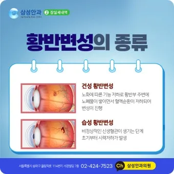시야에 검은점 시야에 까만점이 보일때 원인과 대처법_7