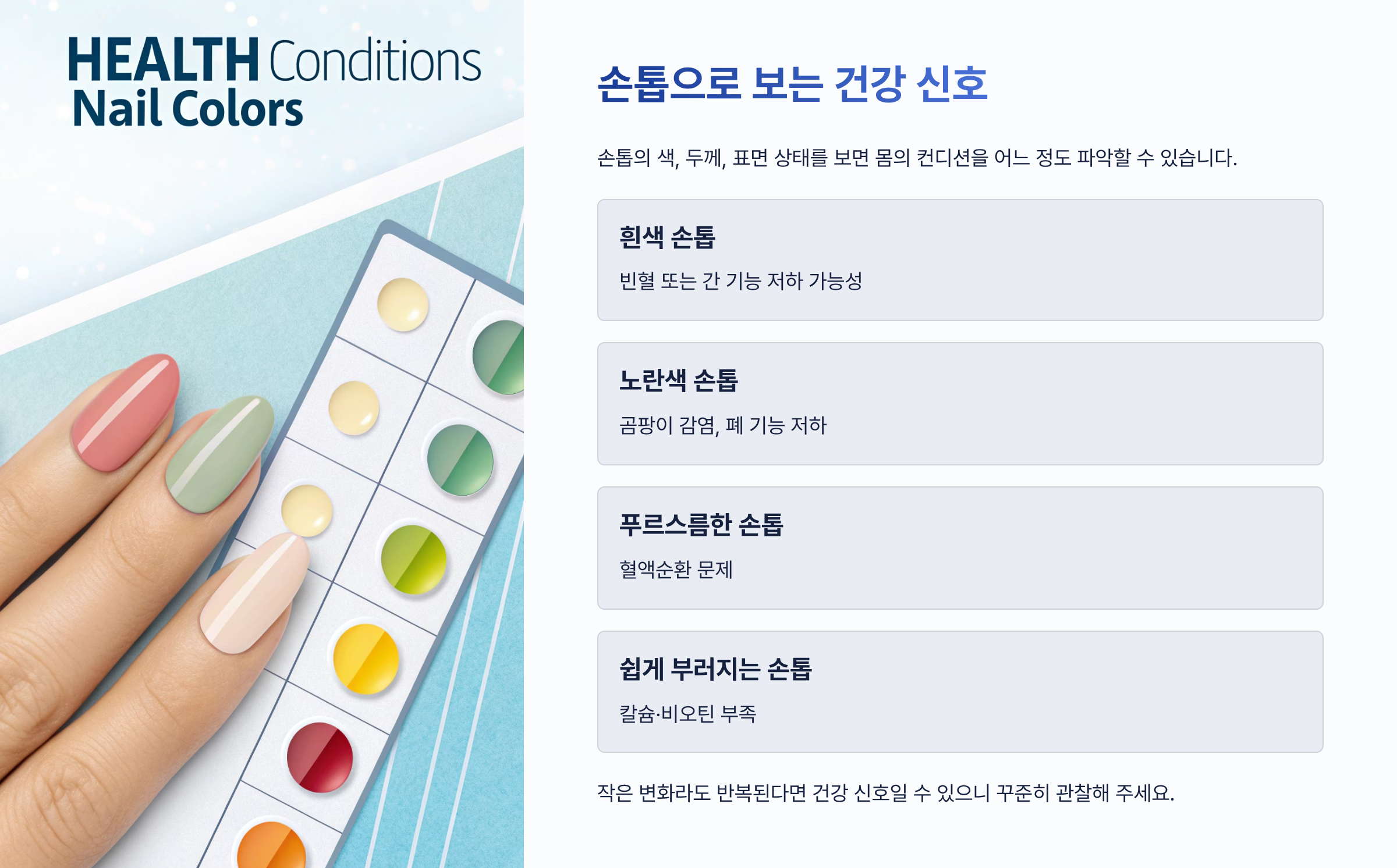 손톱에 세로줄이 생기는 이유 총정리