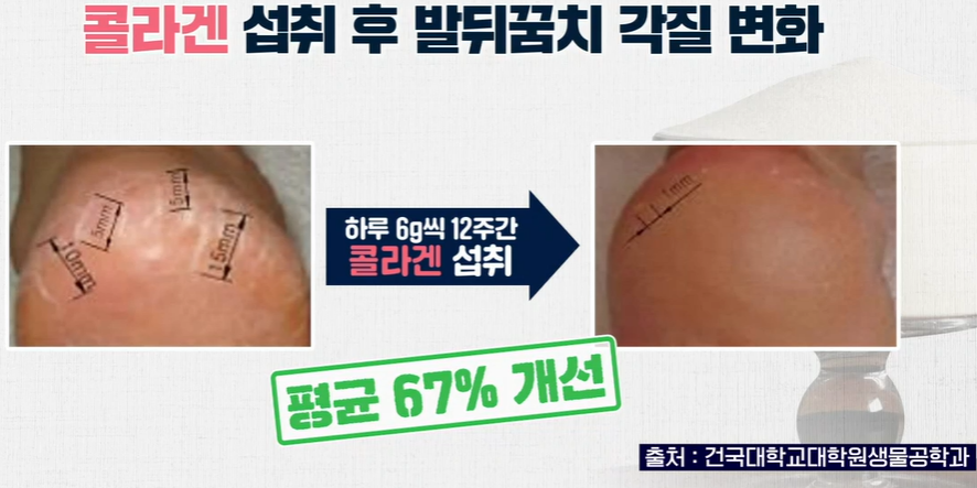 저분자 콜라겐 펩타이드 효능