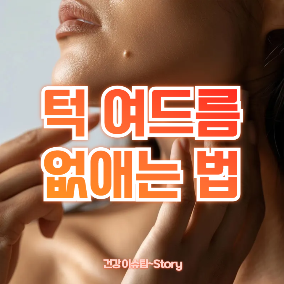 턱 여드름 없애는 법
