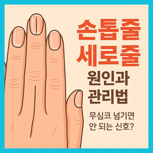 손톱에 세로줄이 생기는 이유