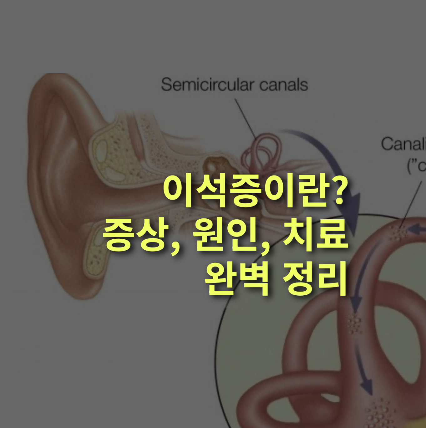 이석증 증상은? 원인과 치료법까지 완벽정리!