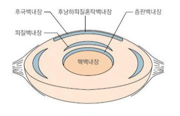 안구 건조증 증상