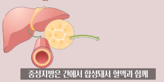 고지혈증 약 없이 건강한 혈관 만드는 법